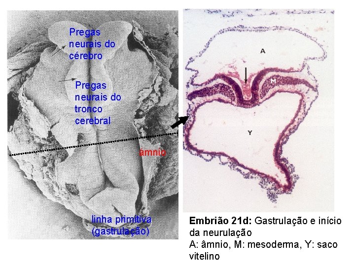 Pregas neurais do cérebro Pregas neurais do tronco cerebral ámnio linha primitiva (gastrulação) Embrião