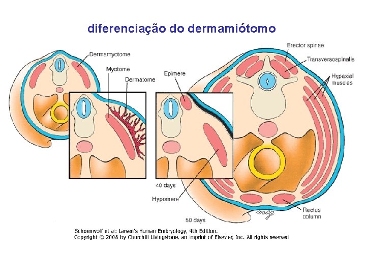 diferenciação do dermamiótomo 