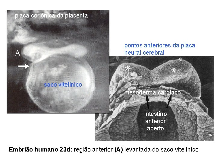 placa coriônica da placenta pontos anteriores da placa neural cerebral A saco vitelínico mesoderma