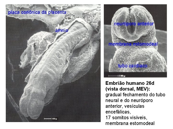 placa coriônica da placenta neuróporo anterior ámnio membrana estomodeal tubo cardíaco Embrião humano 26