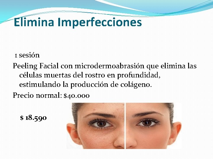 Elimina Imperfecciones 1 sesión Peeling Facial con microdermoabrasión que elimina las células muertas del