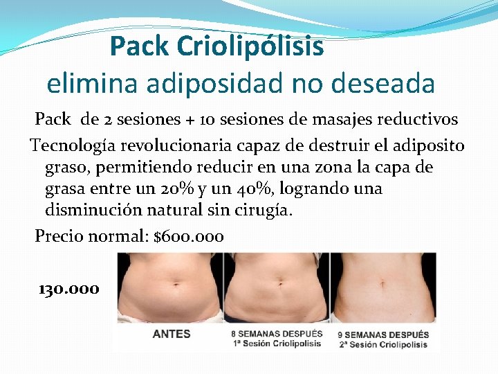 Pack Criolipólisis elimina adiposidad no deseada Pack de 2 sesiones + 10 sesiones de
