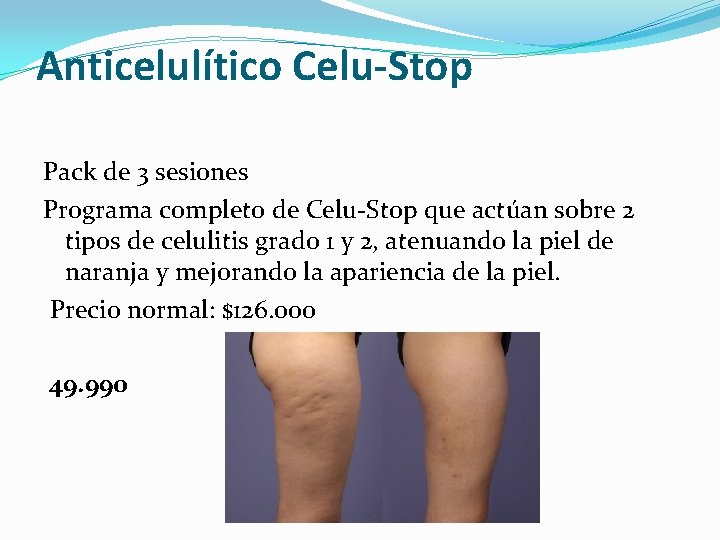 Anticelulítico Celu-Stop Pack de 3 sesiones Programa completo de Celu-Stop que actúan sobre 2