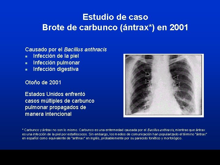 Estudio de caso Brote de carbunco (ántrax*) en 2001 Causado por el Bacillus anthracis