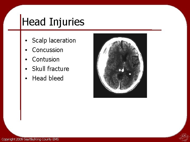 Head Injuries • • • Scalp laceration Concussion Contusion Skull fracture Head bleed Copyright