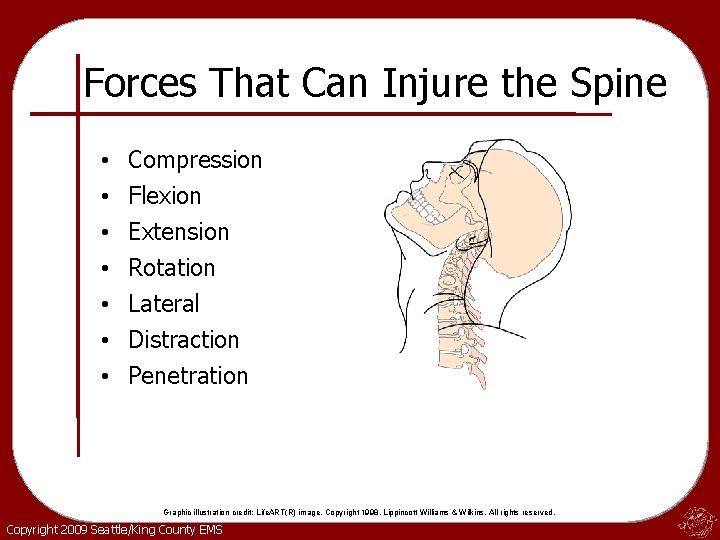 Forces That Can Injure the Spine • • Compression Flexion Extension Rotation Lateral Distraction