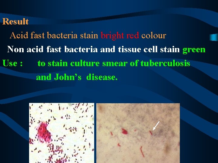 Result Acid fast bacteria stain bright red colour Non acid fast bacteria and tissue
