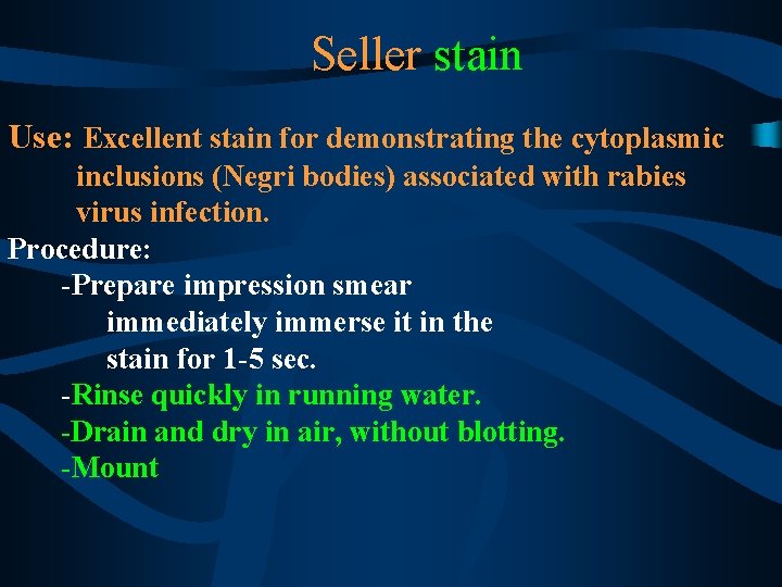 Seller stain Use: Excellent stain for demonstrating the cytoplasmic inclusions (Negri bodies) associated with