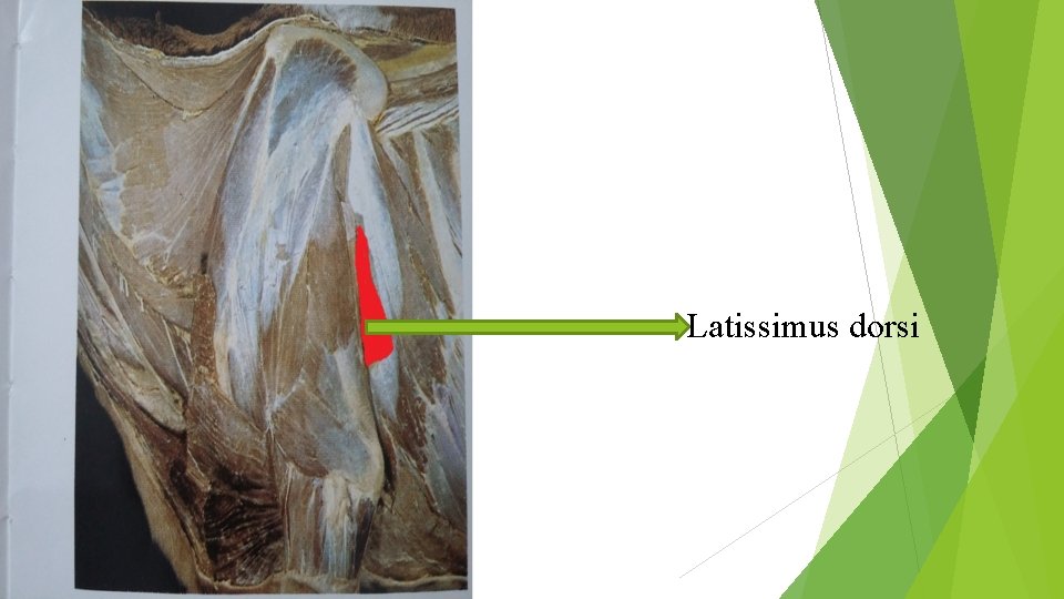 Latissimus dorsi 