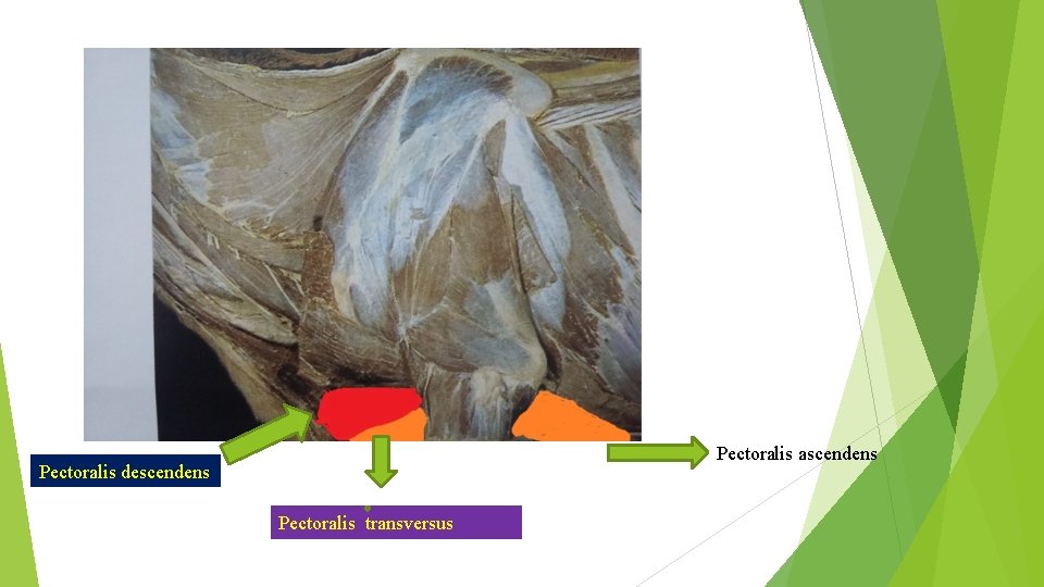 Pectoralis ascendens Pectoralis descendens Pectoralis transversus 