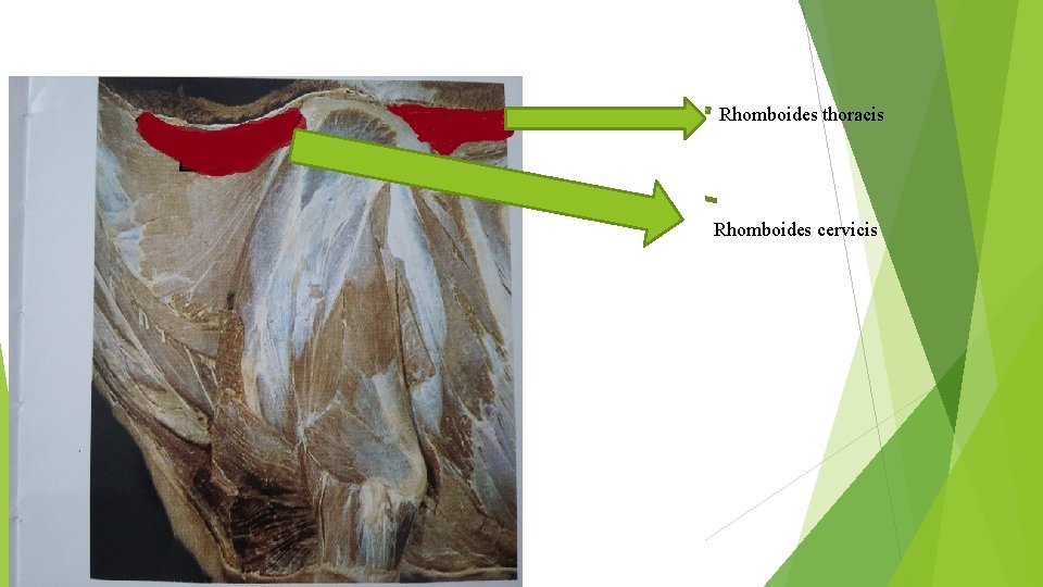 Rhomboides thoracis Rhomboides cervicis 