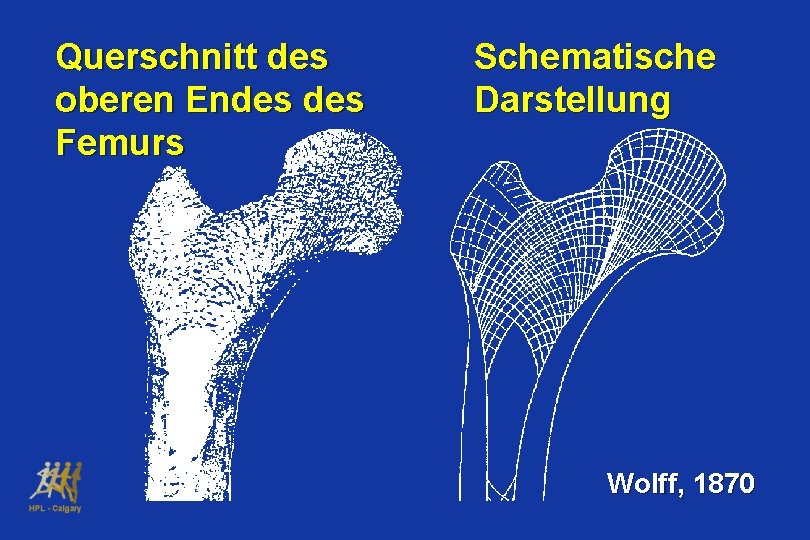 Querschnitt des oberen Endes Femurs Schematische Darstellung Wolff, 1870 