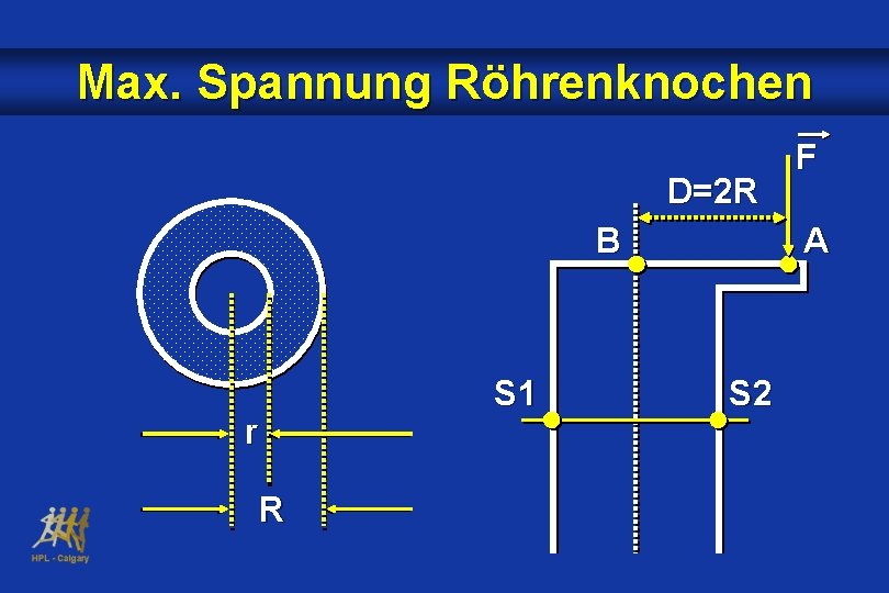 Max. Spannung Röhrenknochen D=2 R B S 1 r R F A S 2