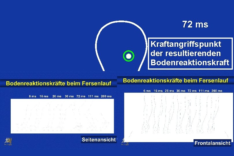 72 ms Kraftangriffspunkt der resultierenden Bodenreaktionskraft Medial Lateral 