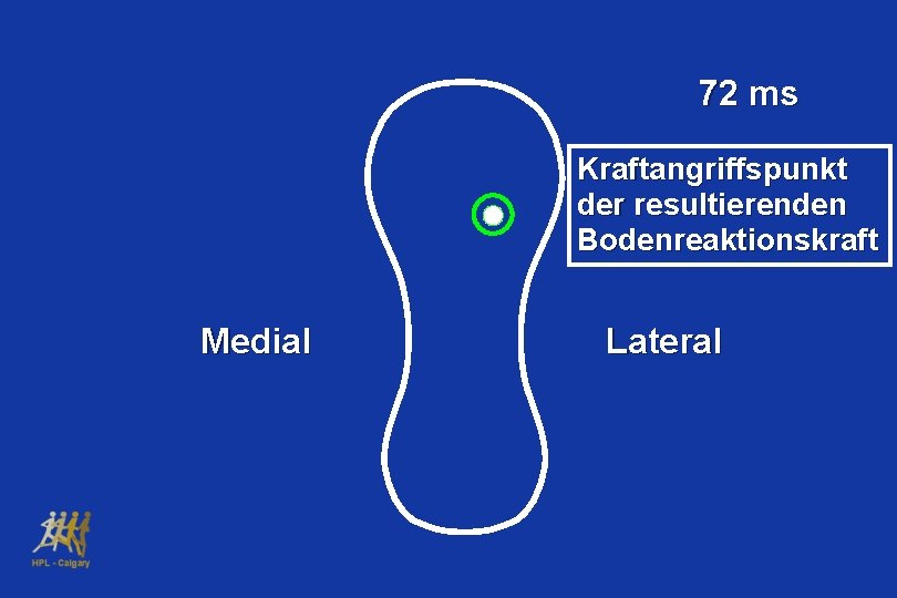 72 ms Kraftangriffspunkt der resultierenden Bodenreaktionskraft Medial Lateral 