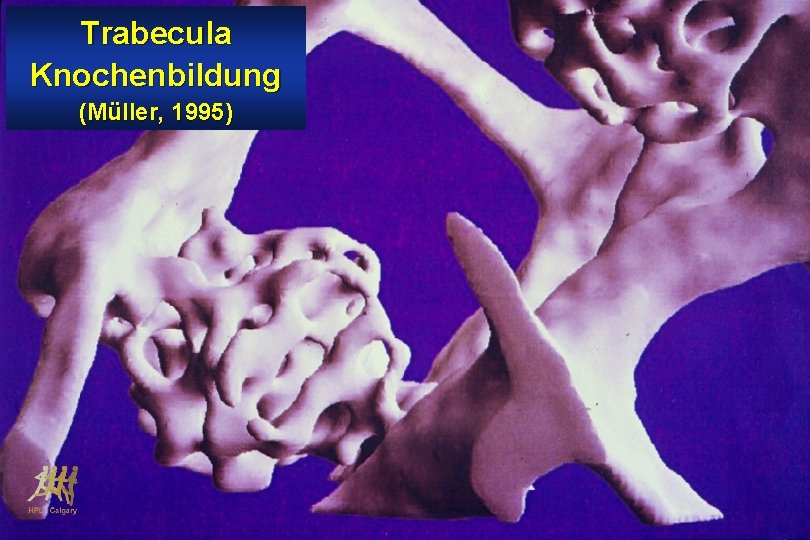 Trabecula Knochenbildung (Müller, 1995) 