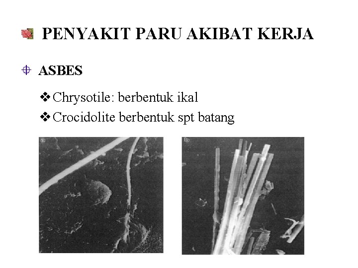 PENYAKIT PARU AKIBAT KERJA ASBES v Chrysotile: berbentuk ikal v Crocidolite berbentuk spt batang