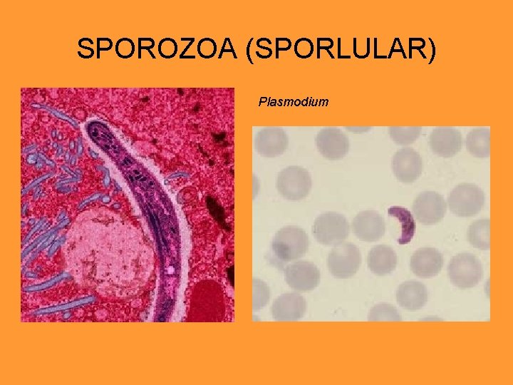 SPOROZOA (SPORLULAR) Plasmodium 