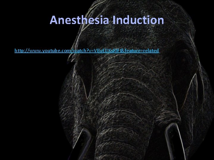 Anesthesia Induction http: //www. youtube. com/watch? v=VBy. EDXs. RIFI&feature=related 