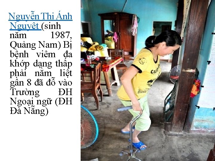  Nguyễn Thị Ánh Nguyệt (sinh năm 1987, Quảng Nam) Bị bệnh viêm đa