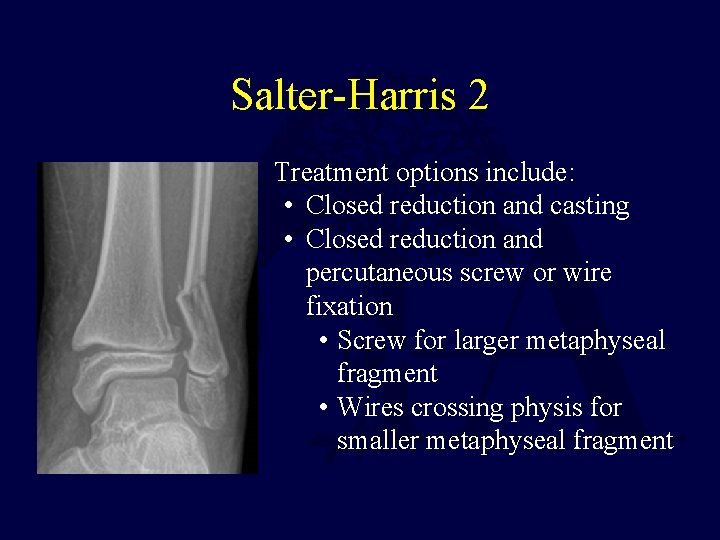 Salter-Harris 2 • Treatment options include: • Closed reduction and casting • Closed reduction