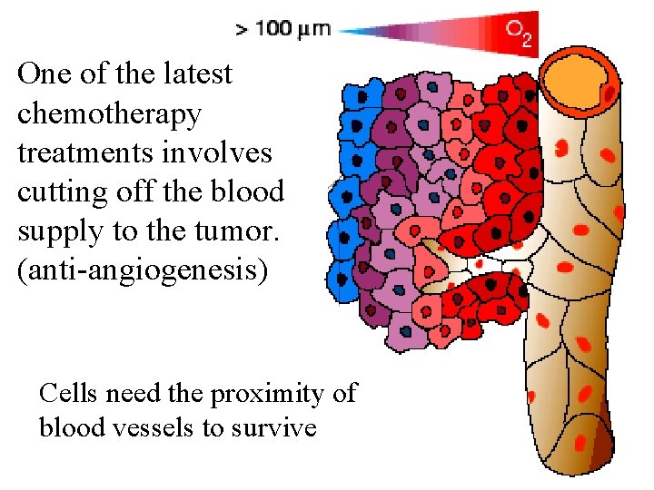 One of the latest chemotherapy treatments involves cutting off the blood supply to the