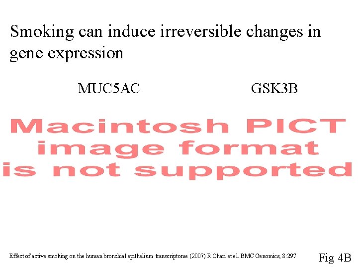 Smoking can induce irreversible changes in gene expression MUC 5 AC GSK 3 B