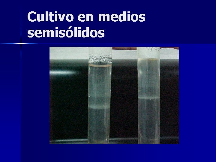 Cultivo en medios semisólidos 