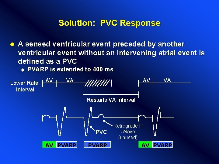 Solution: PVC Response l A sensed ventricular event preceded by another ventricular event without