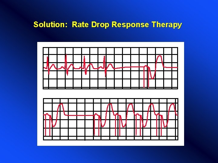 Solution: Rate Drop Response Therapy Solution: Rate Drop Response Therapy