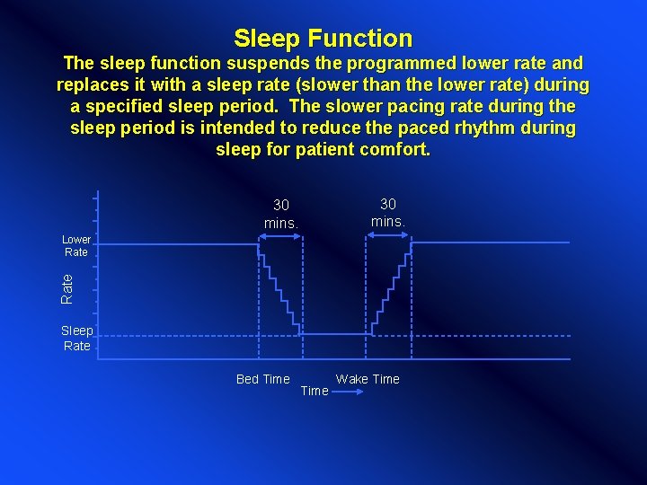 Sleep Function The sleep function suspends the programmed lower rate and replaces it with