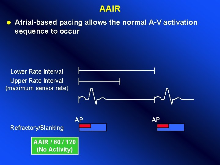 AAIR l Atrial-based pacing allows the normal A-V activation sequence to occur Lower Rate