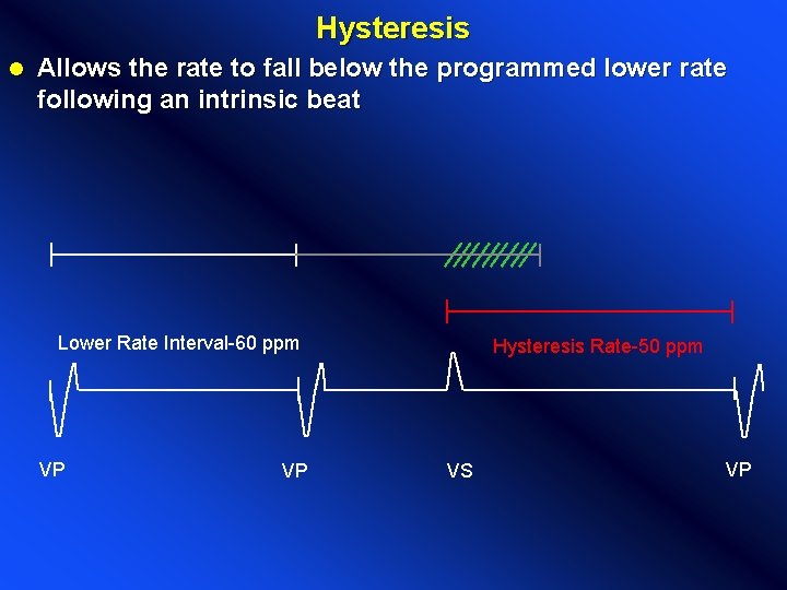 Hysteresis l Allows the rate to fall below the programmed lower rate following an