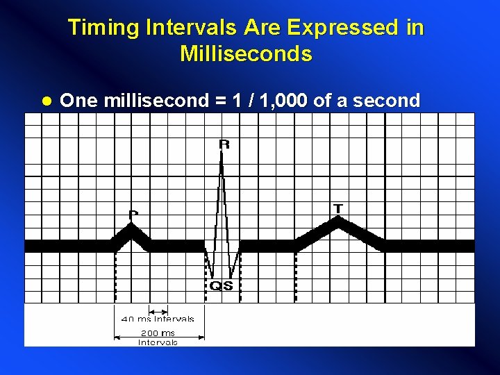 Timing Intervals Are Expressed in Milliseconds l One millisecond = 1 / 1, 000