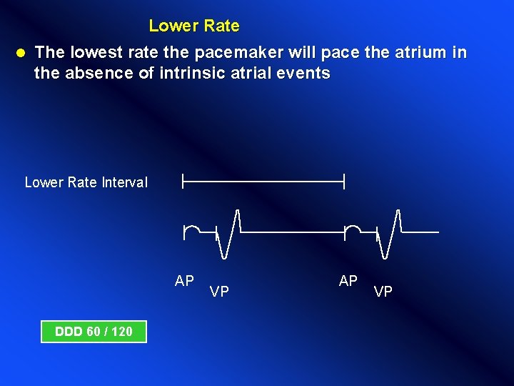 Lower Rate l The lowest rate the pacemaker will pace the atrium in the Lower Rate l The lowest rate the pacemaker will pace the atrium in the