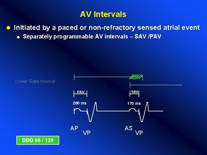 AV Intervals l Initiated by a paced or non-refractory sensed atrial event u Separately AV Intervals l Initiated by a paced or non-refractory sensed atrial event u Separately