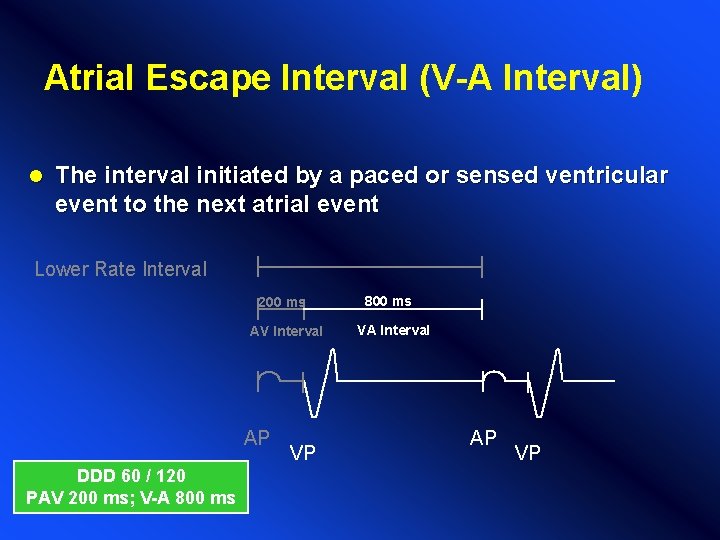 Atrial Escape Interval (V-A Interval) l The interval initiated by a paced or sensed