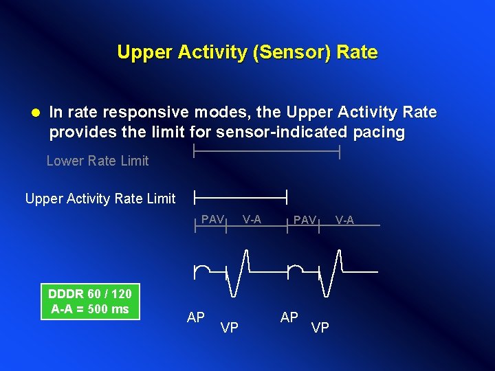 Upper Activity (Sensor) Rate l In rate responsive modes, the Upper Activity Rate provides