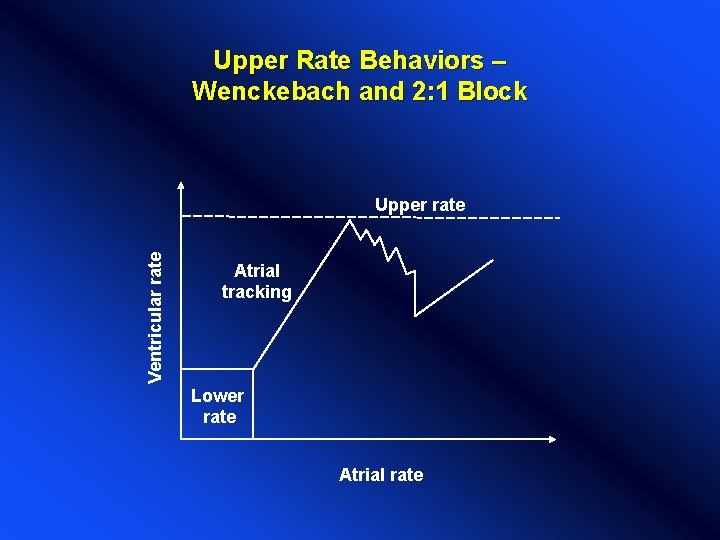 Upper Rate Behaviors – Wenckebach and 2: 1 Block Ventricular rate Upper rate Atrial