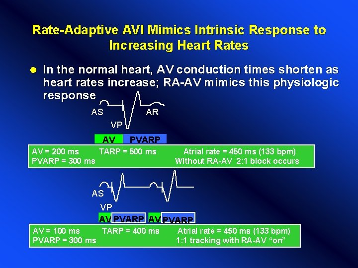 Rate-Adaptive AVI Mimics Intrinsic Response to Increasing Heart Rates l In the normal heart, Rate-Adaptive AVI Mimics Intrinsic Response to Increasing Heart Rates l In the normal heart,