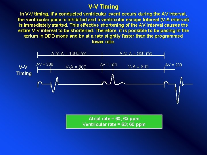 V-V Timing In V-V timing, if a conducted ventricular event occurs during the AV