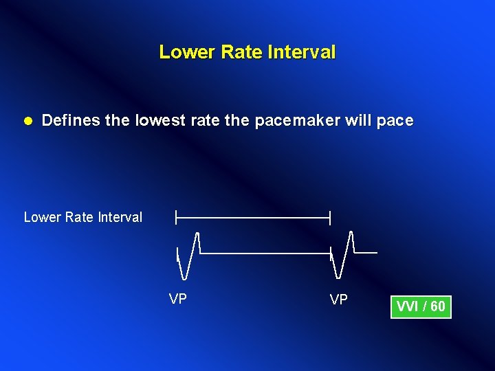 Lower Rate Interval l Defines the lowest rate the pacemaker will pace Lower Rate