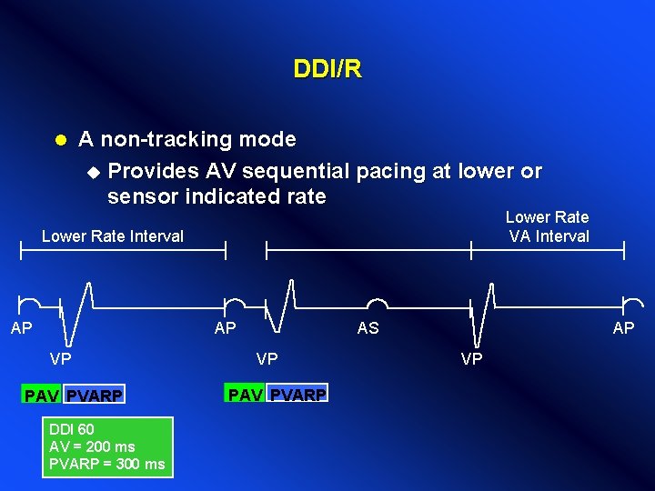 DDI/R l A non-tracking mode u Provides AV sequential pacing at lower or sensor DDI/R l A non-tracking mode u Provides AV sequential pacing at lower or sensor