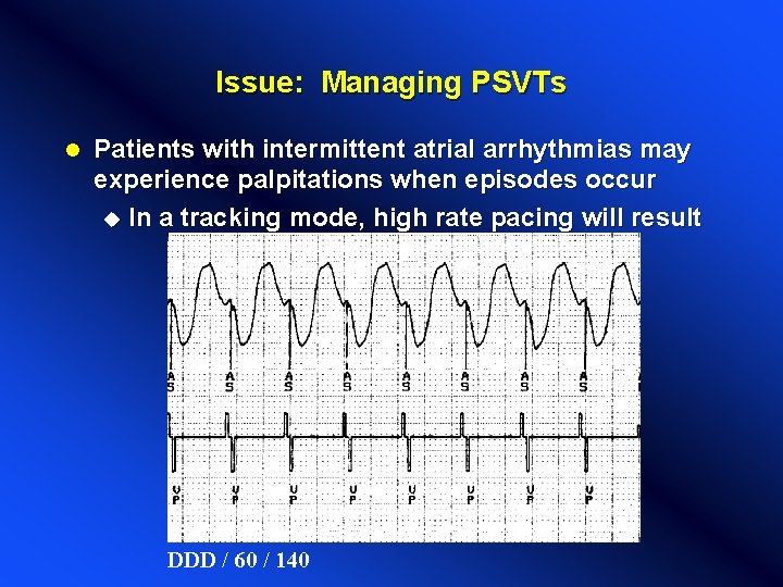 Issue: Managing PSVTs l Patients with intermittent atrial arrhythmias may experience palpitations when episodes