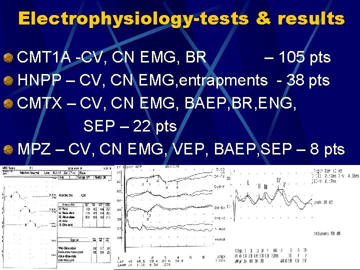 Electrophysiology-tests & results CMT 1 A -CV, CN EMG, BR – 105 pts HNPP