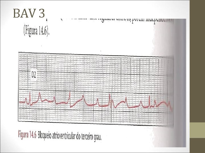 BAV 3 