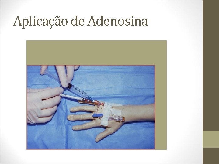 Aplicação de Adenosina 