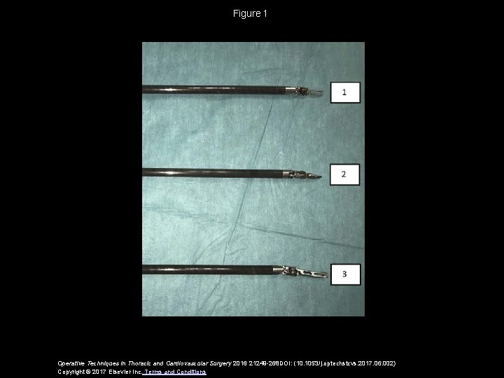 Figure 1 Operative Techniques in Thoracic and Cardiovascular Surgery 2016 21249 -268 DOI: (10. 1053/j. Figure 1 Operative Techniques in Thoracic and Cardiovascular Surgery 2016 21249 -268 DOI: (10. 1053/j.