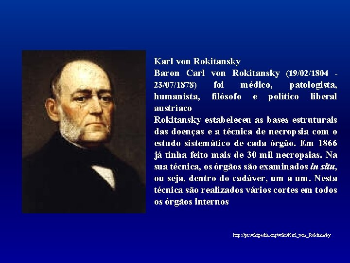 Karl von Rokitansky Baron Carl von Rokitansky (19/02/1804 - 23/07/1878) foi médico, patologista, humanista,