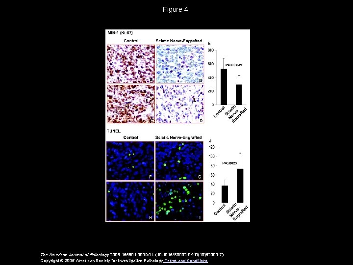 Figure 4 The American Journal of Pathology 2005 166891 -900 DOI: (10. 1016/S 0002